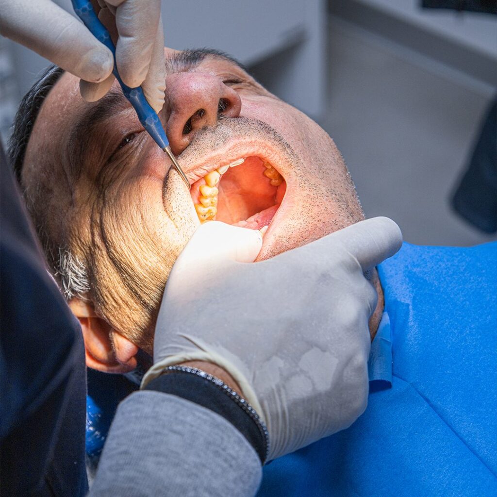 Cosmesi Dentale